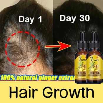 Сыворотка для роста волос с имбирем, Эссенция для быстрого Отрастания волос, масло для лечения Облысения, кожи головы, средства против Выпадения волос, Восстанавливающие Сухие Вьющиеся Повреждения